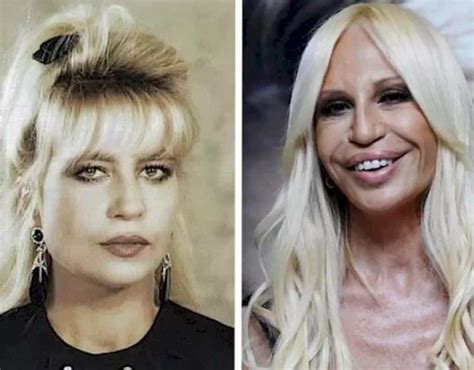 versace daughter plastic surgery|donatella Versace face what happened.